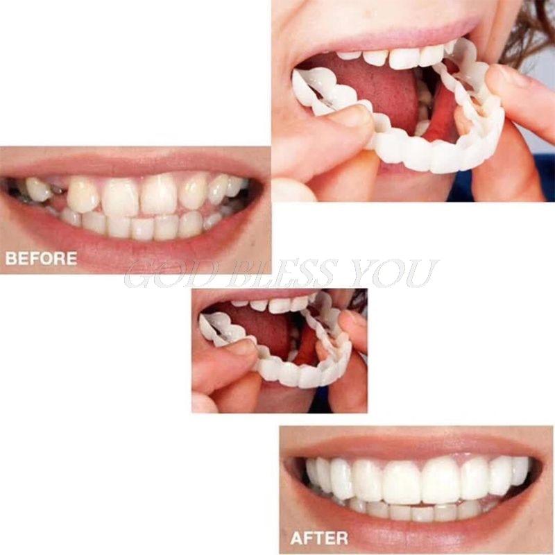Sorriso Perfeito™️ Dentaduras removíveis (Kit superior + inferior) - Outlet De Todos