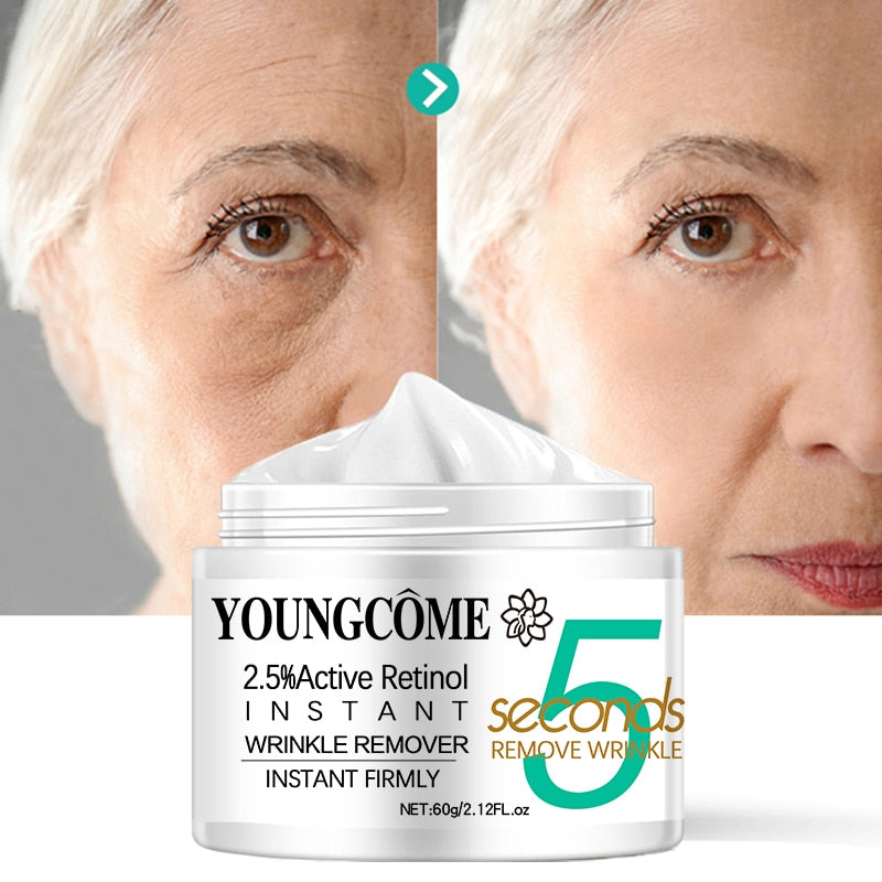 Botox instantâneo anti envelhecimento